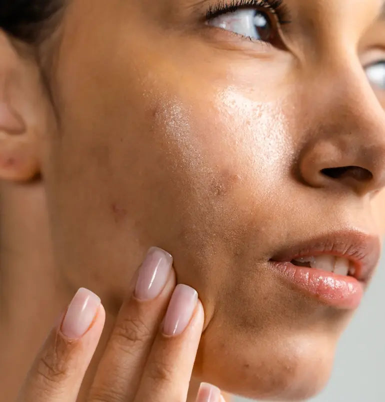 For-Oily-Skin For-Oily-Skin Kay Pedals